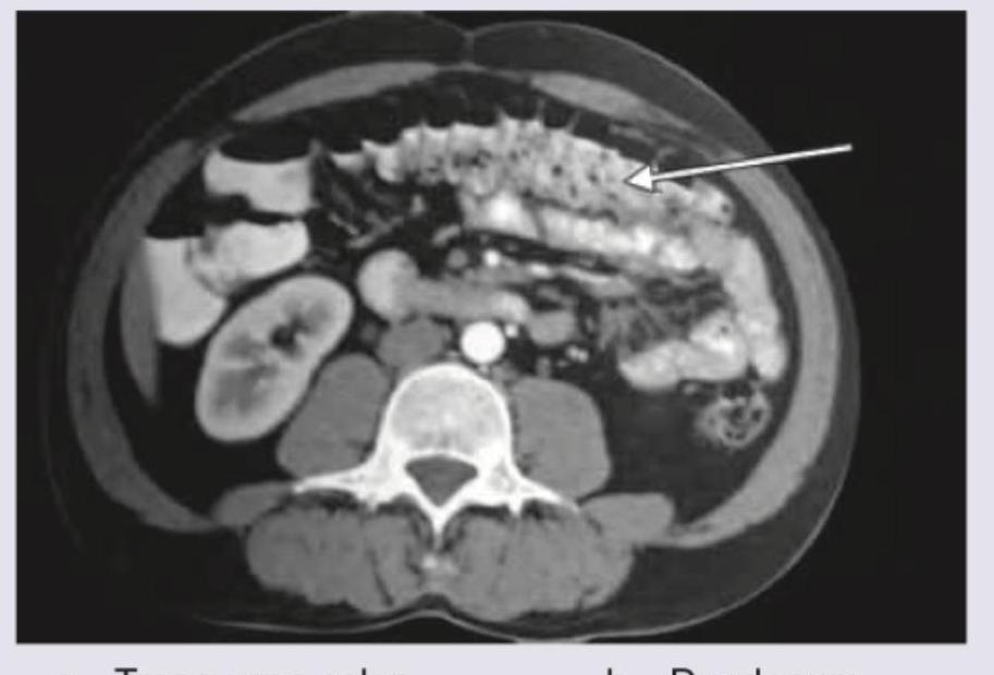 Image for question 120