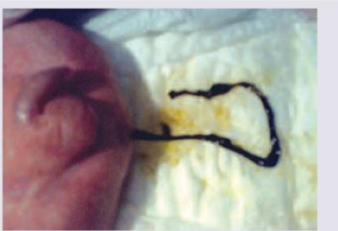 Image for question 999