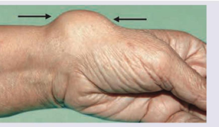 Image for question 267