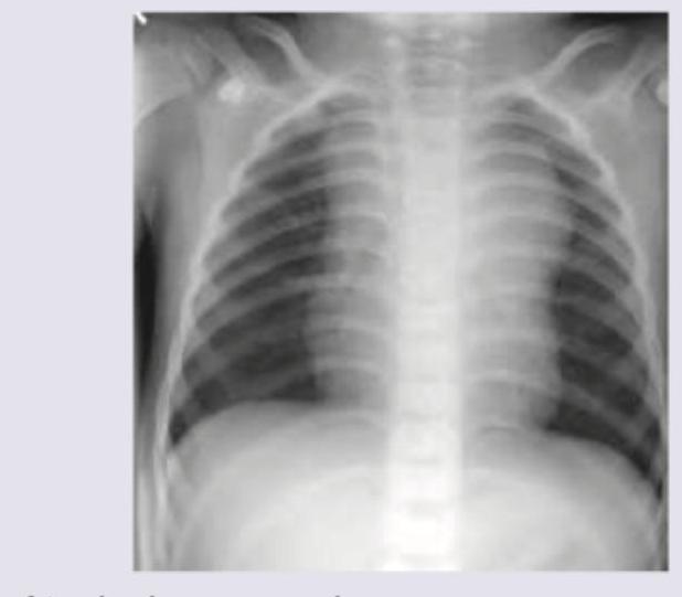 Image for question 148