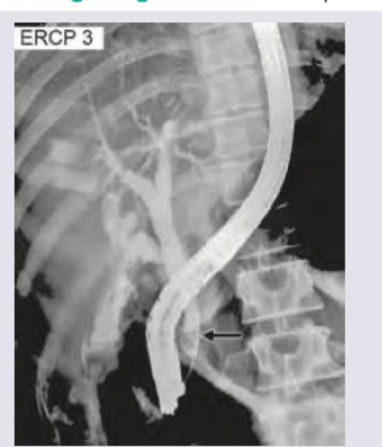 Image for question 496