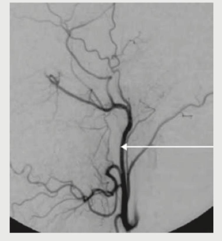 Image for question 114