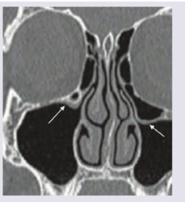 Image for question 48