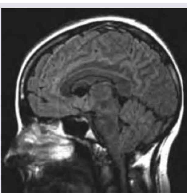 Image for question 17