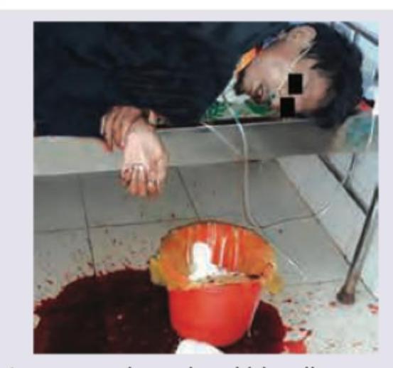 Image for question 494