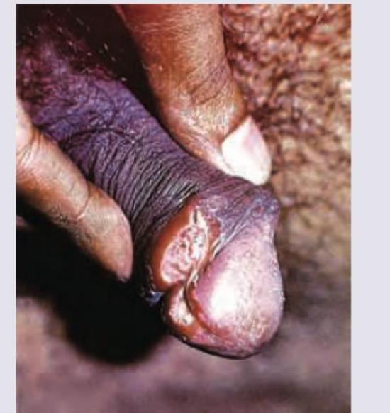 Image for question 172