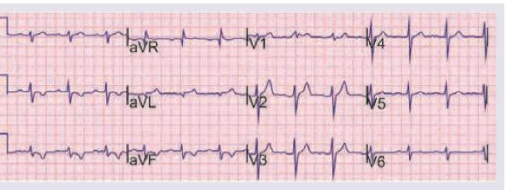 Image for question 956