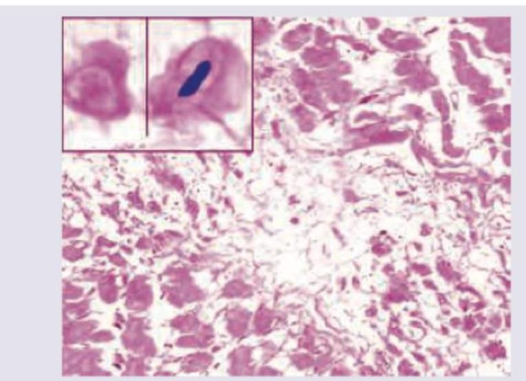 Image for question 202