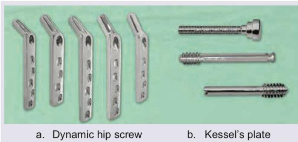 Image for question 901