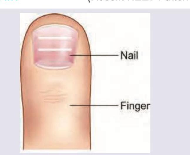 Image for question 18