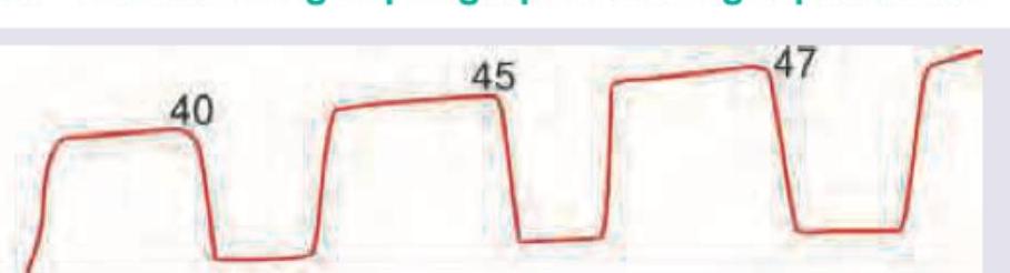 Image for question 295