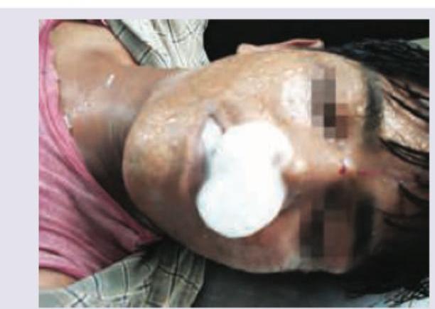 Image for question 211