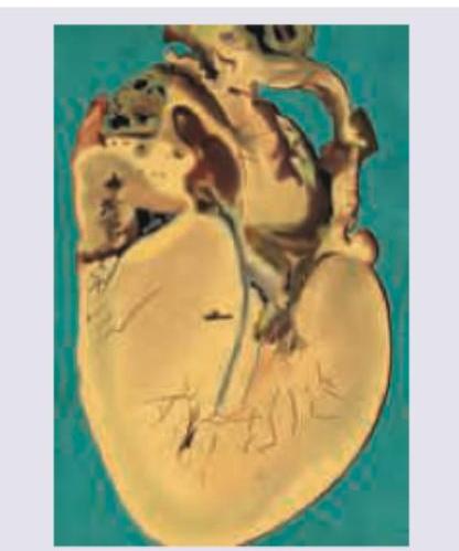 Image for question 199