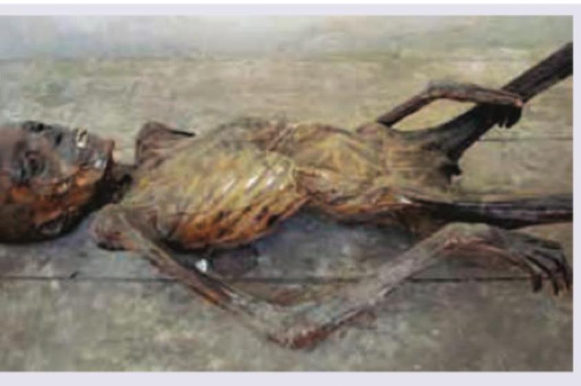 Image for question 309