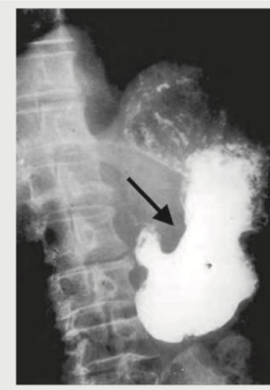 Image for question 177