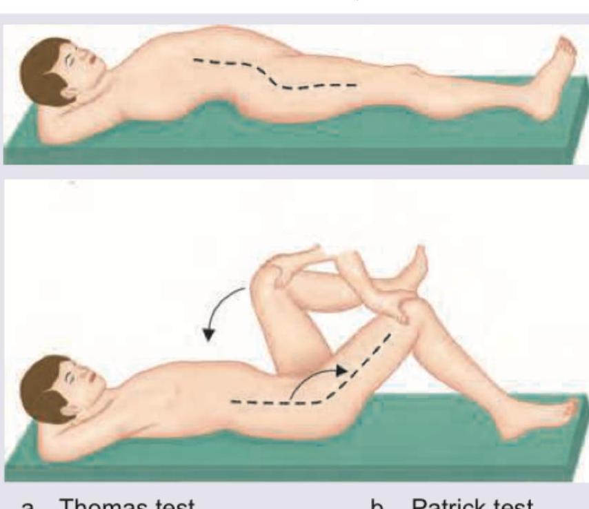 Image for question 994