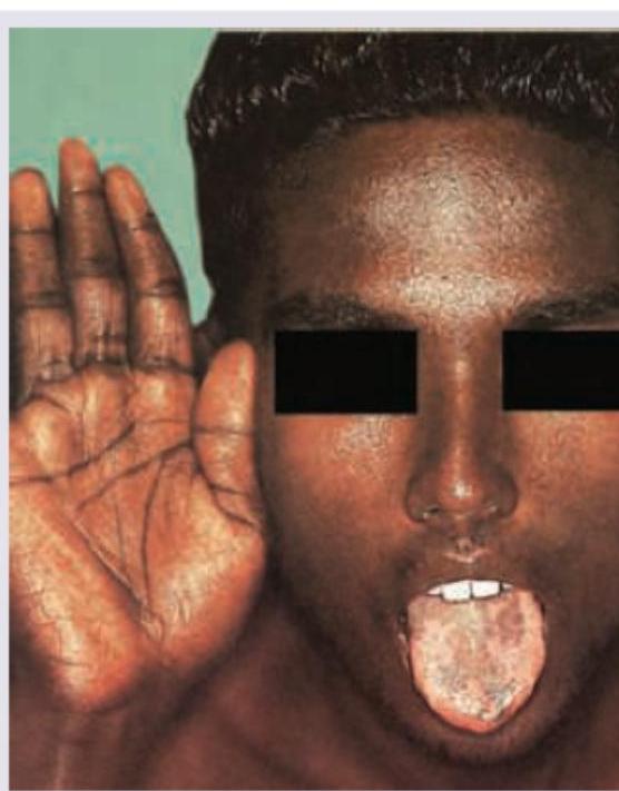 Image for question 1314