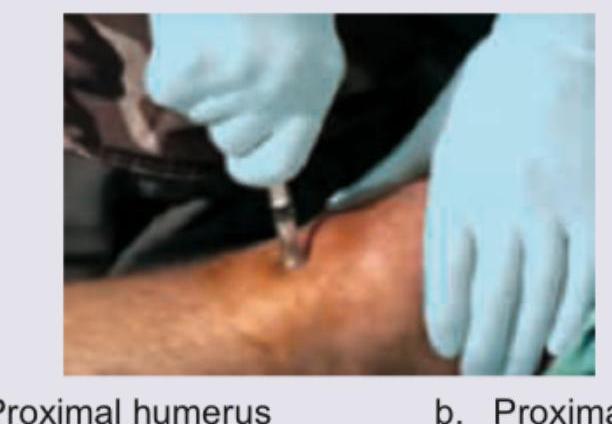 Image for question 15