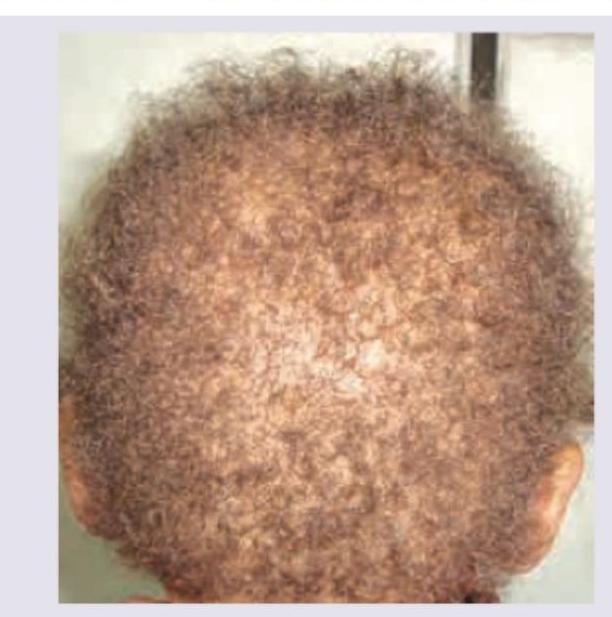 Image for question 638