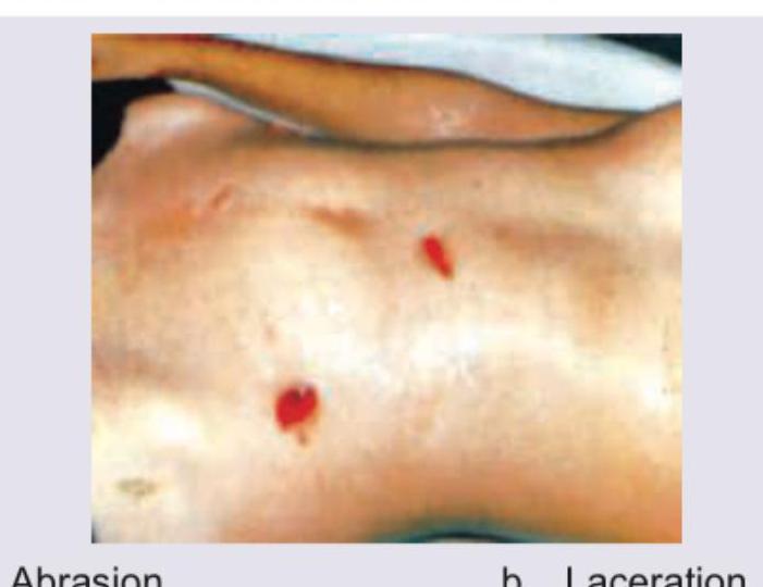 Image for question 508