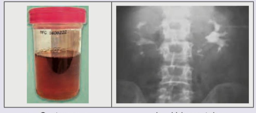 Image for question 941