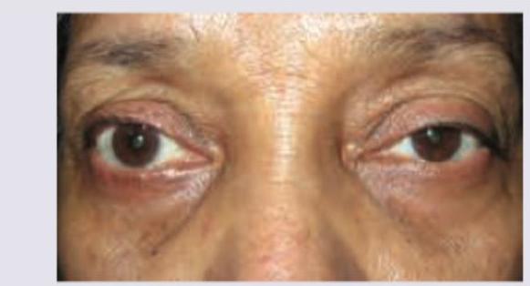 Image for question 364