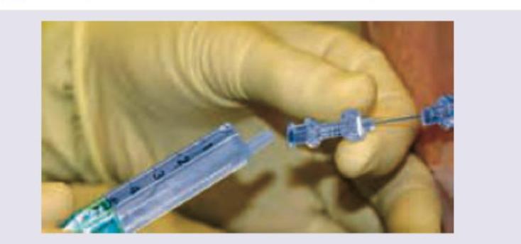 Image for question 186