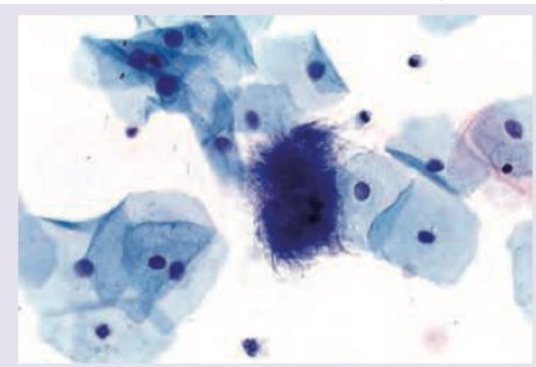 Image for question 117