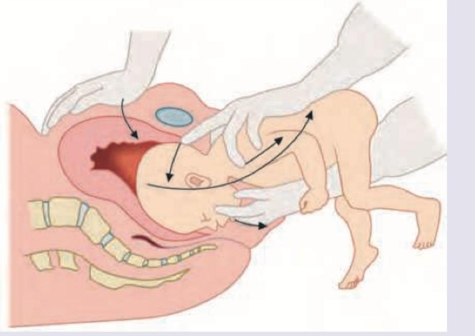 Image for question 849