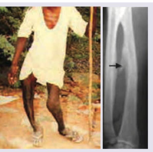 Image for question 118