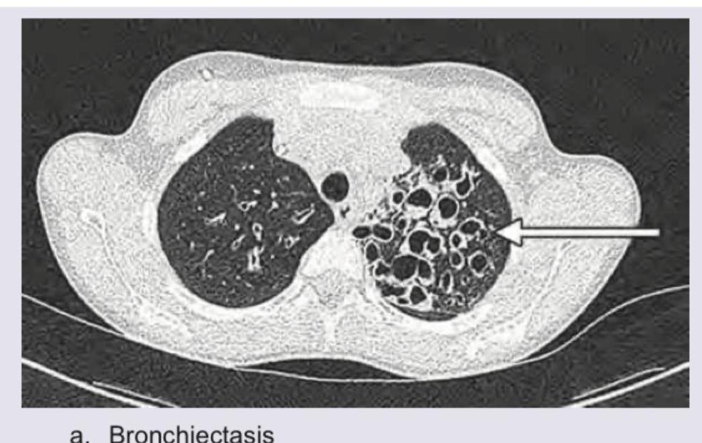 Image for question 20