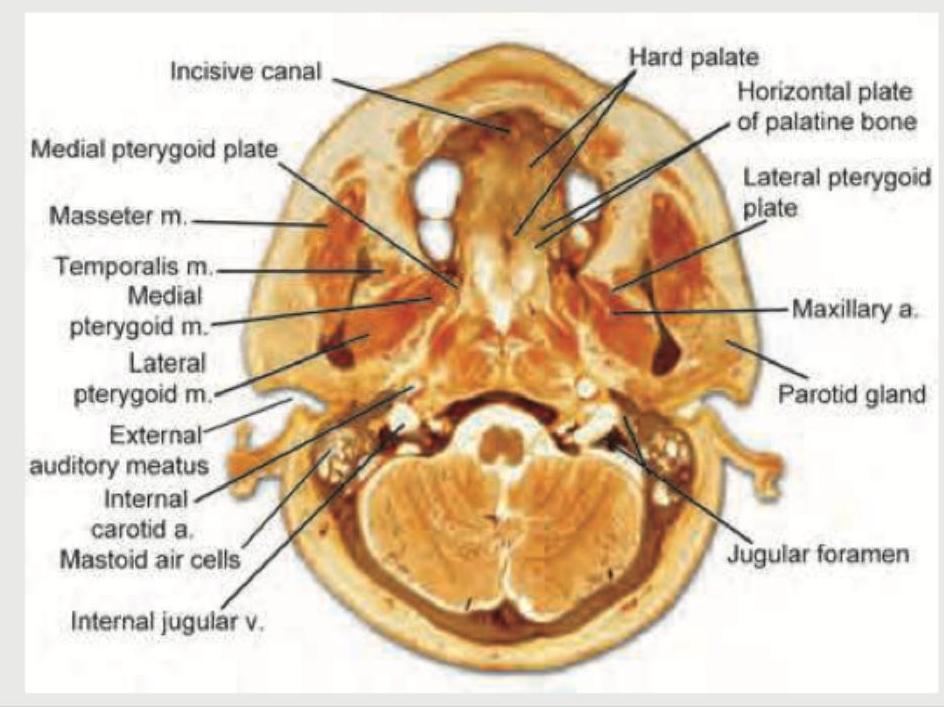 Image for question 1154