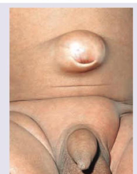 Image for question 783