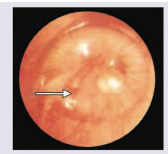 Image for question 202