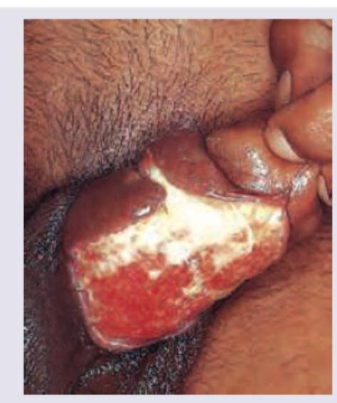 Image for question 171