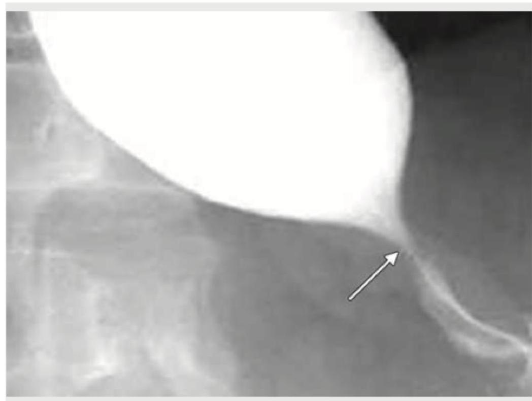 Image for question 174