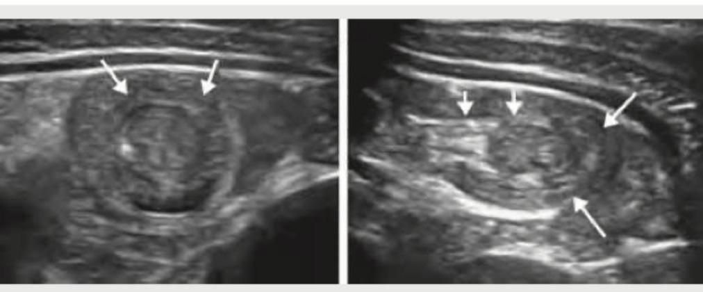 Image for question 255