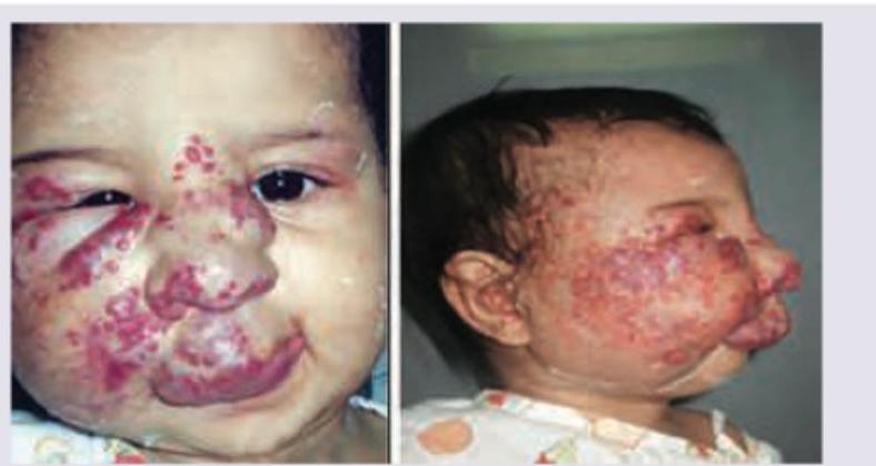 Image for question 165