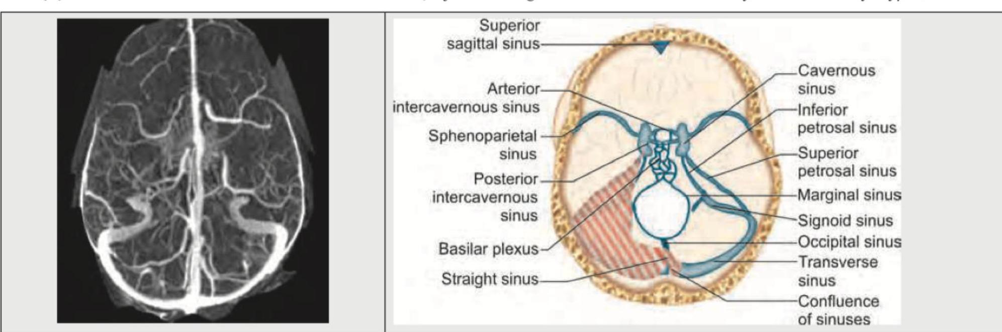 Image for question 160