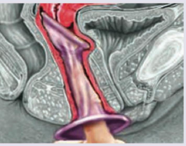 Image for question 551