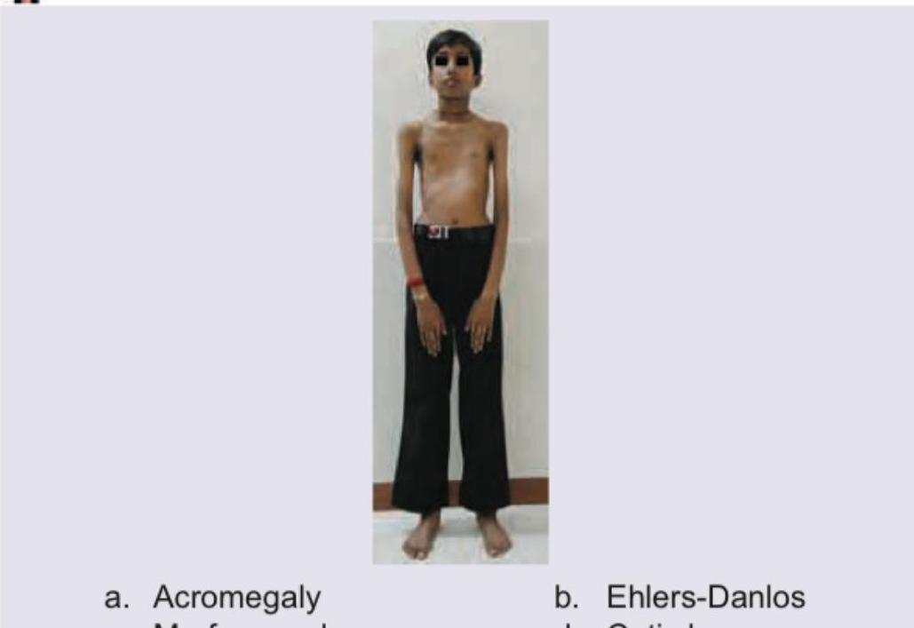 Image for question 636