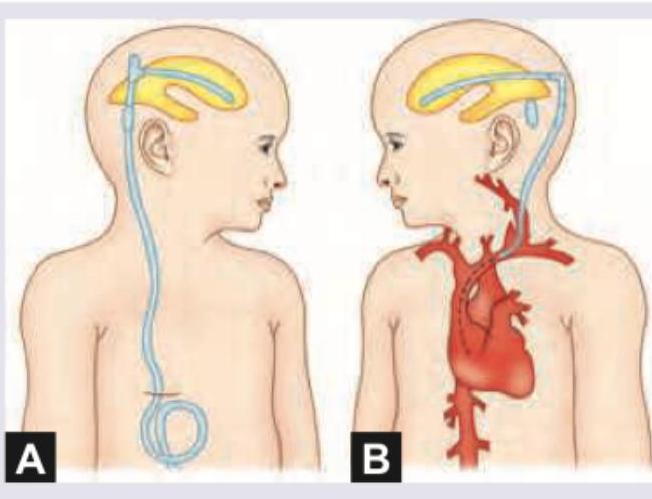 Image for question 128