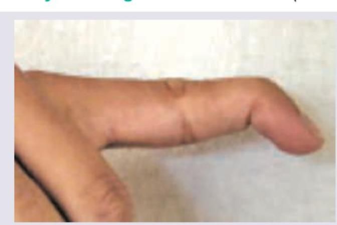 Image for question 79