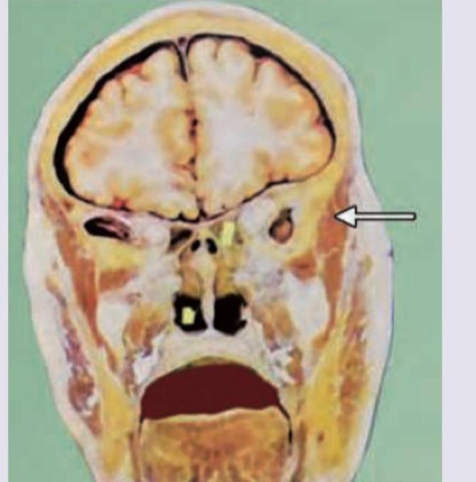 Image for question 4