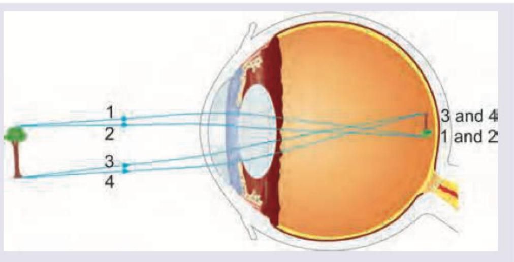 Image for question 254