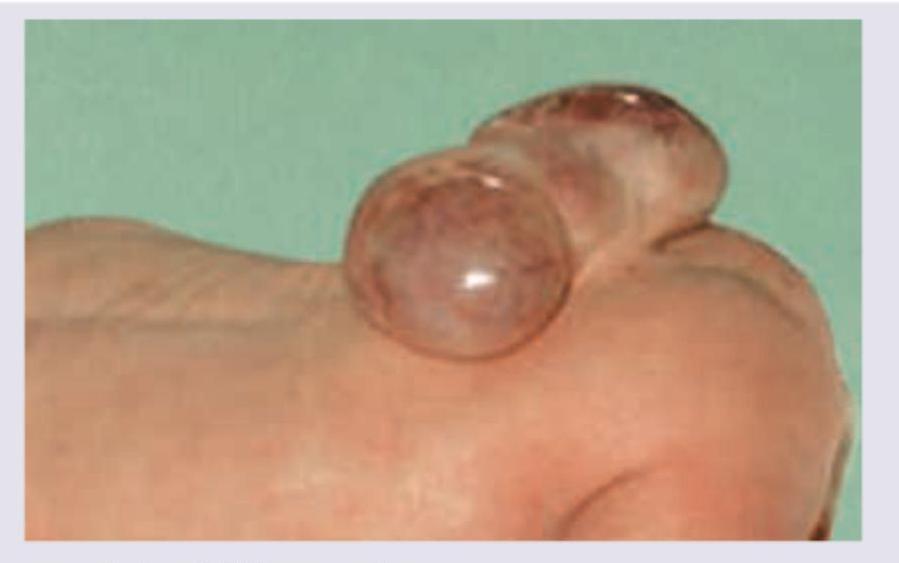 Image for question 200