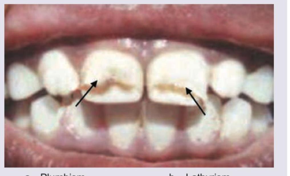 Image for question 92