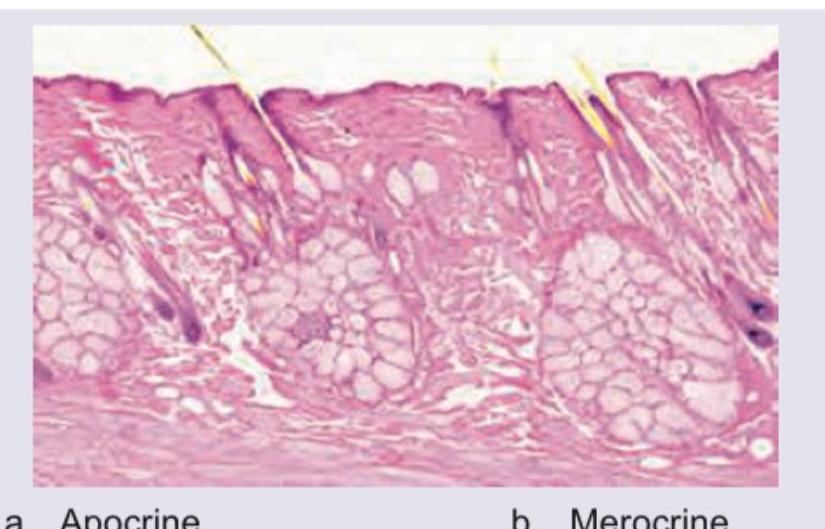 Image for question 161