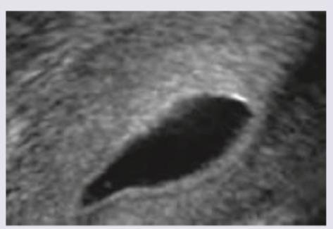 Image for question 919