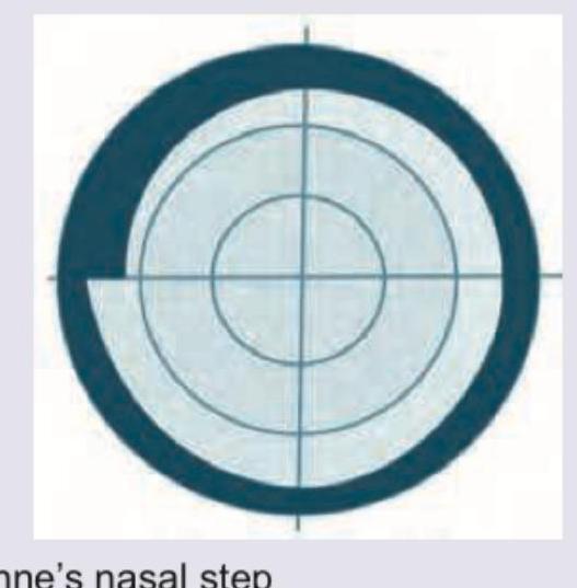 Image for question 325